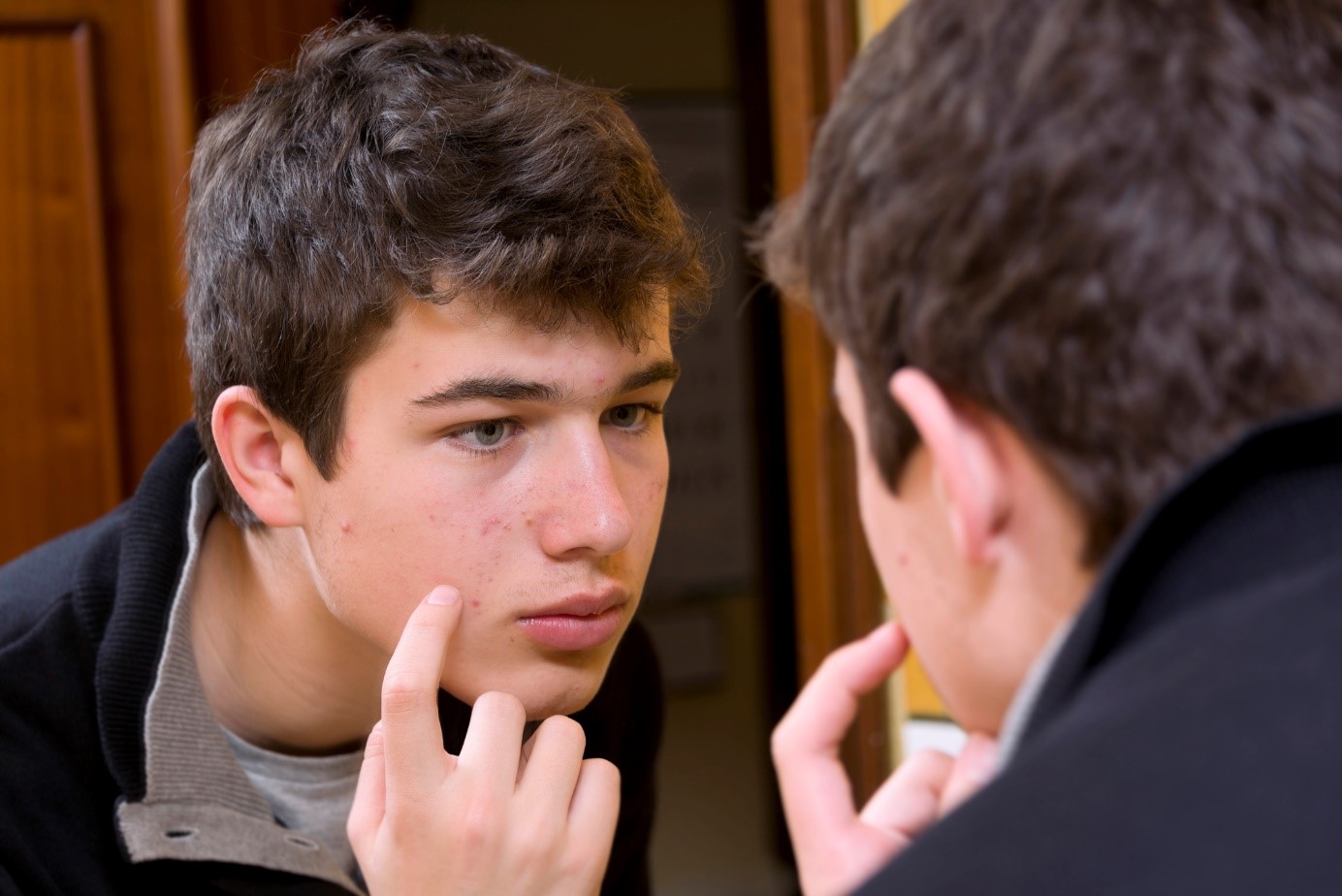 Garçon avec de l'acné sur le visage