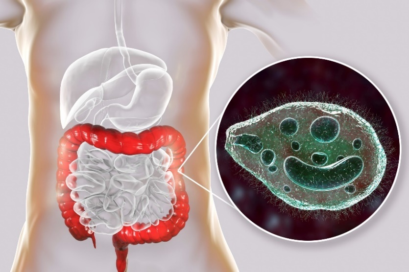 Balantidium coli - parasite infectant le gros intestin du tube digestif humain.