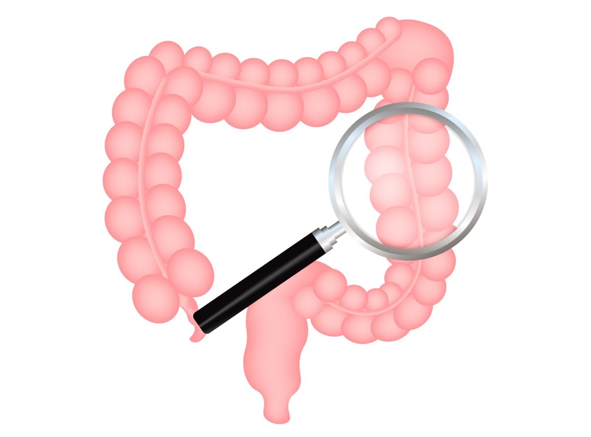 Animation de l'intestin et des pellicules comme représentation du diagnostic des troubles intestinaux