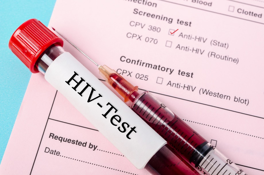 Test de diagnostic de la présence d'anticorps anti-VIH dans l'échantillon de sang d'un patient