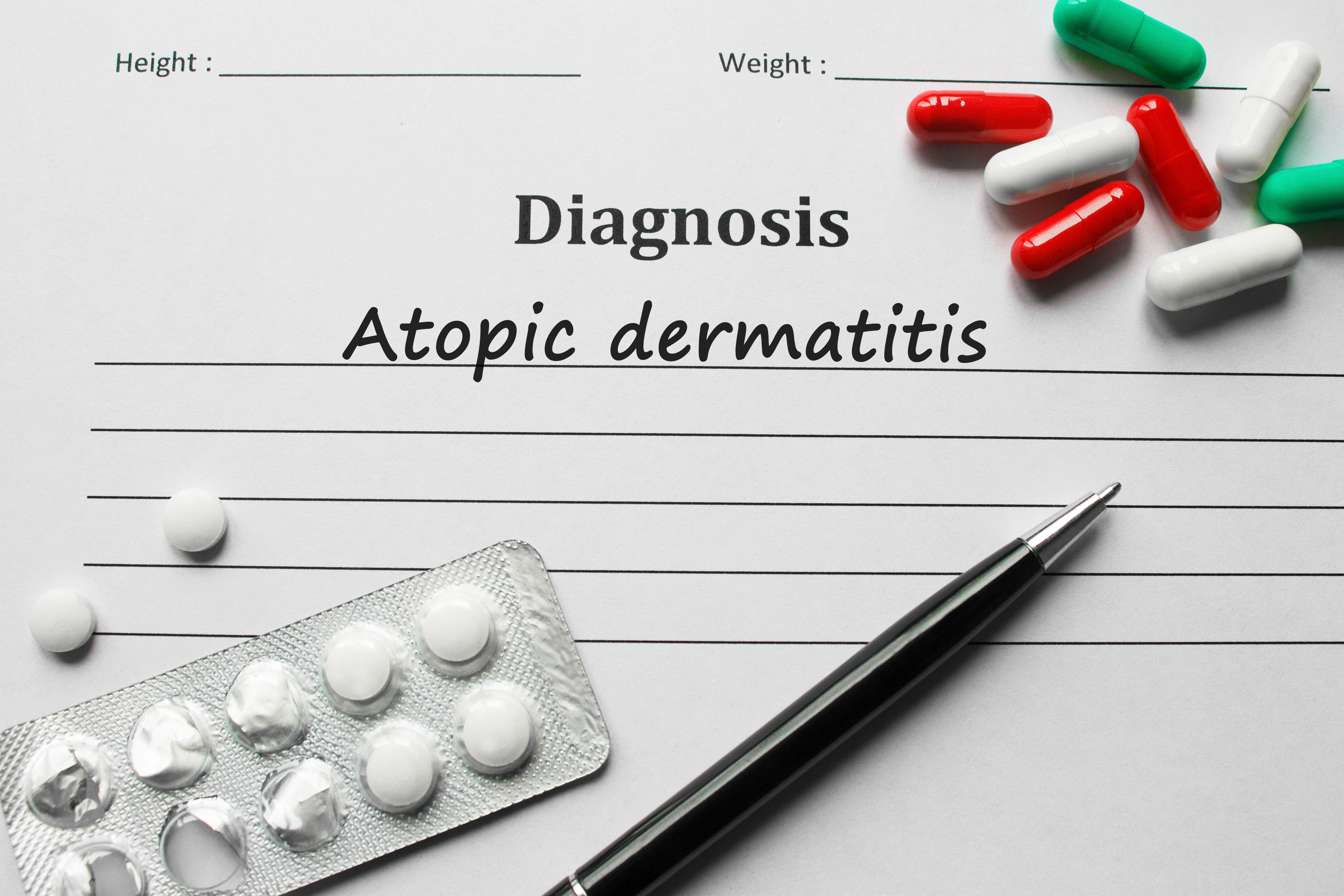 Diagnostic de la dermatite atopique