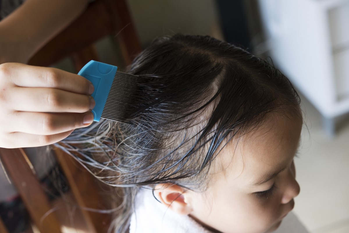 Une jeune fille aux cheveux lavés qui se débarrasse des poux avec un peigne spécialement conçu à cet effet.