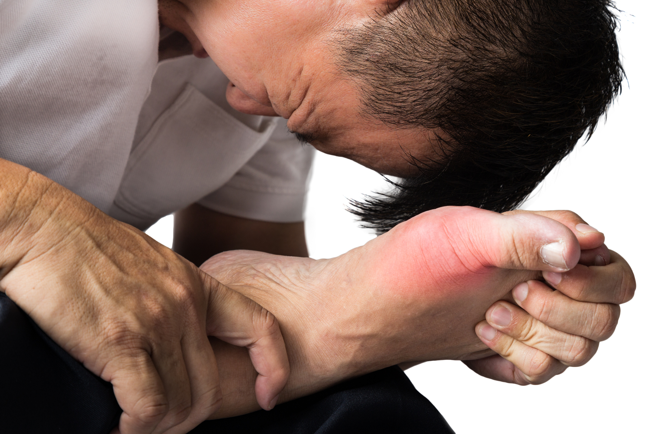 Quest-ce Qui Déclenche Une Crise De Fibromyalgie Goutte : Qu'est-ce que la maladie de la goutte, pourquoi survient-elle