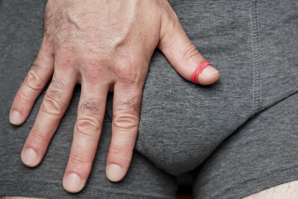 Phimosis et paraphimosis (rétrécissement du prépuce) quelles sont les causes et les symptômes