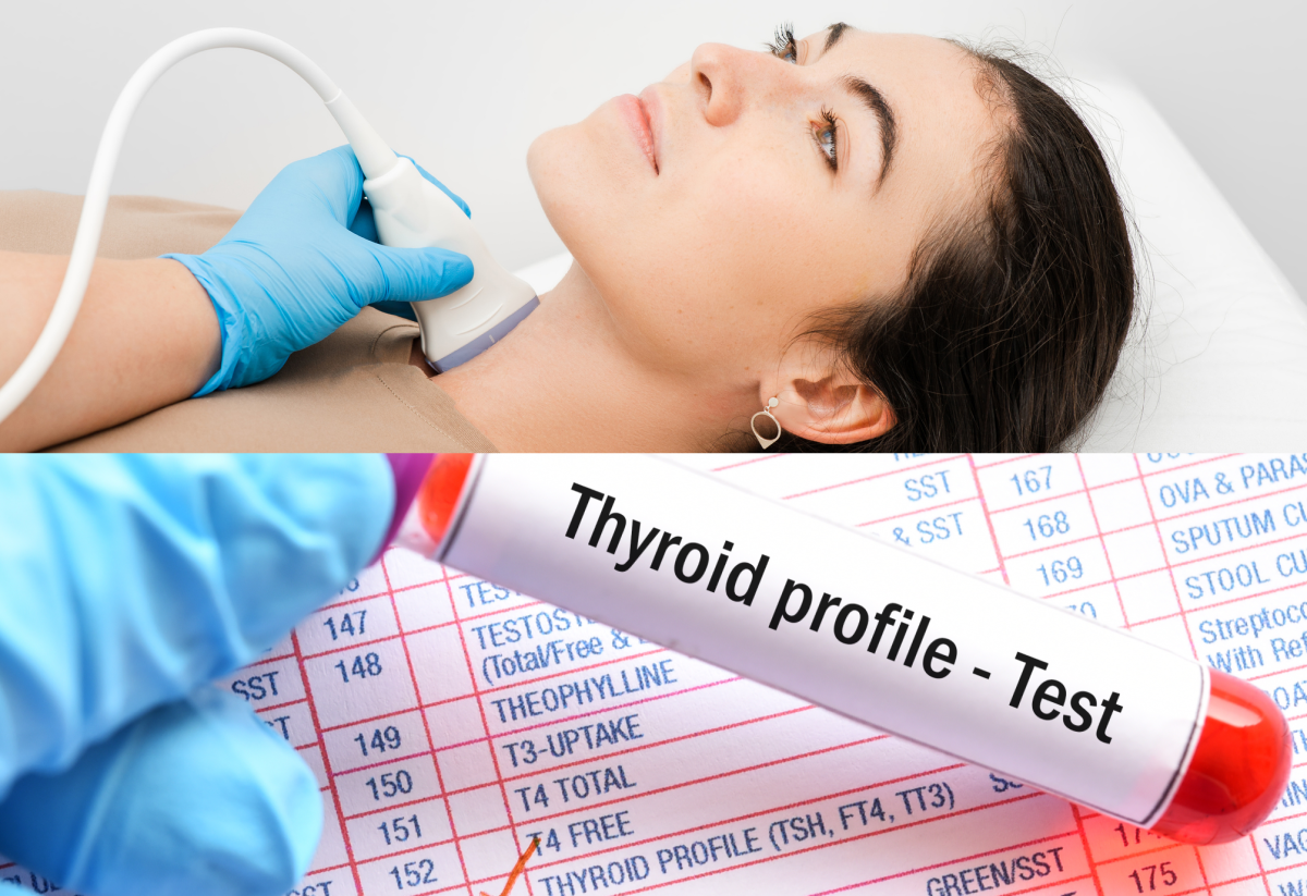 Examen de la thyroïde - prise de sang, dosage des hormones et SONO/USG