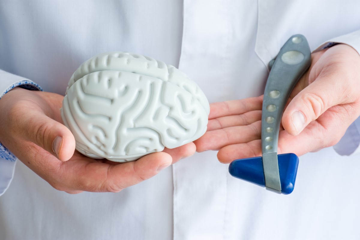 Examen par un neurologue, le médecin tient une maquette du cerveau et procède à un examen neurologique avec un marteau.