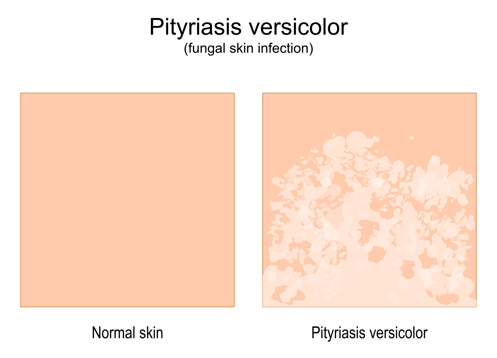 Comparaison de la peau normale et de la peau présentant des signes de maladie