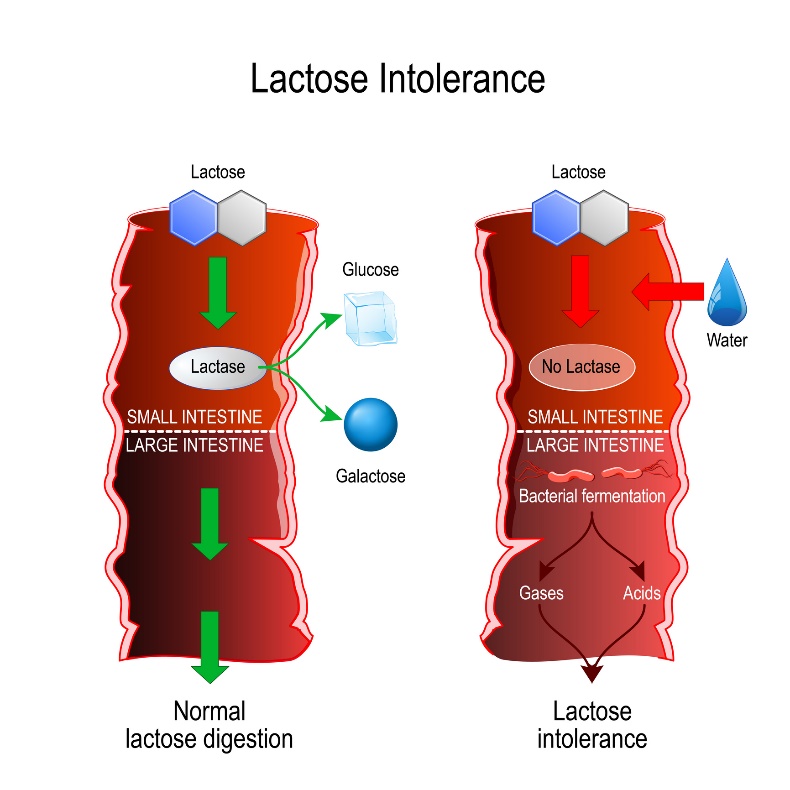 Comparaison de la digestion physiologique et de l'intolérance au lactose