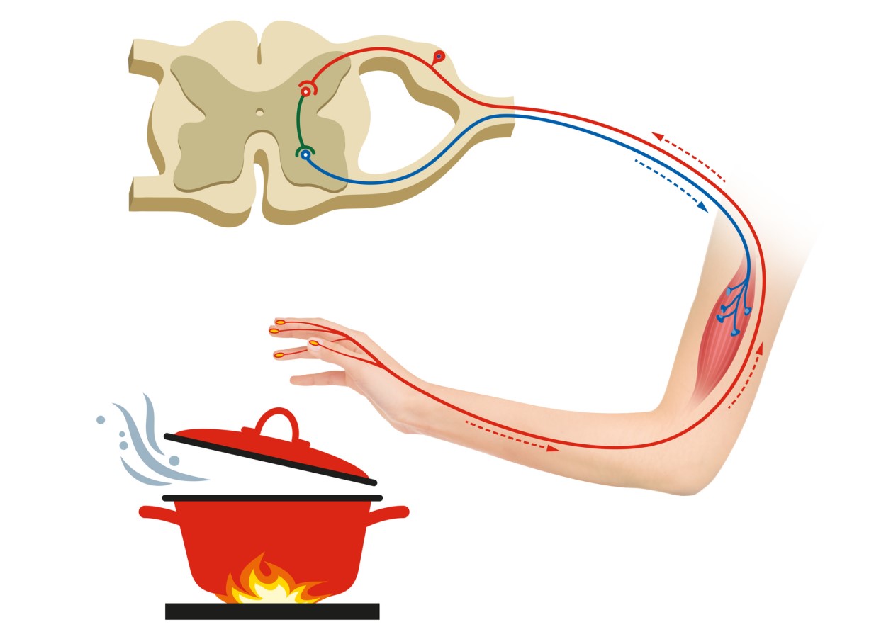 Représentation de l'arc réflexe - un réflexe qui nous permet de percevoir des stimuli dangereux, dans ce cas la protection contre les brûlures - main avec voies nerveuses et représentation de l'éloignement de la main d'une casserole chaude.