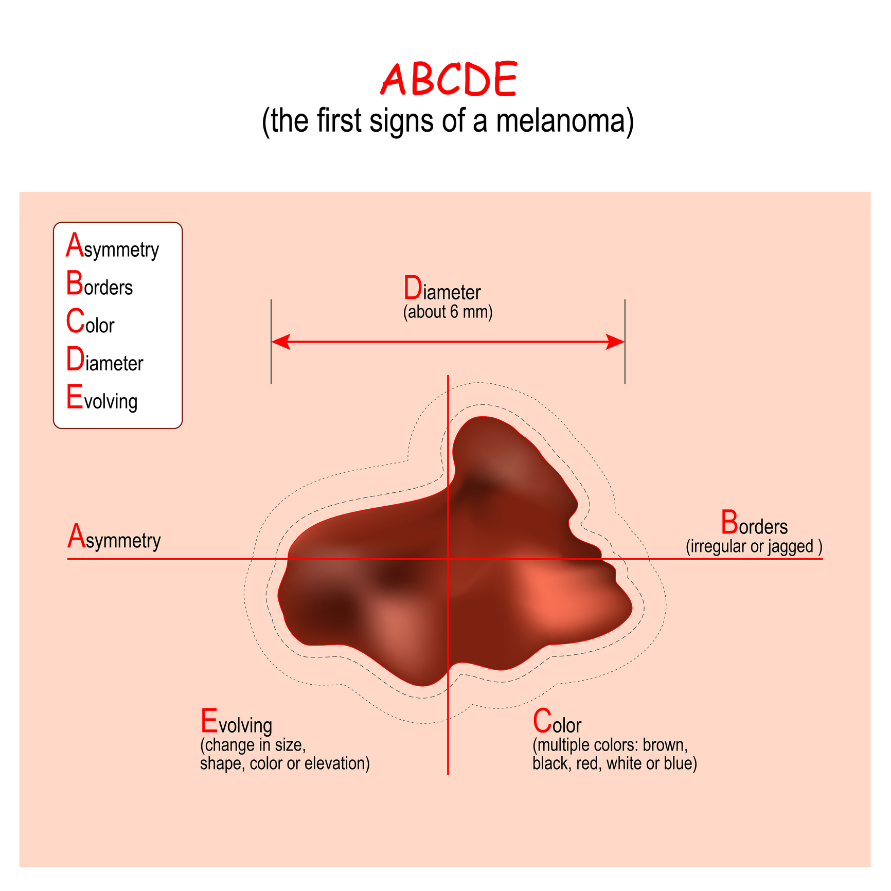 Algorithme ABCDE