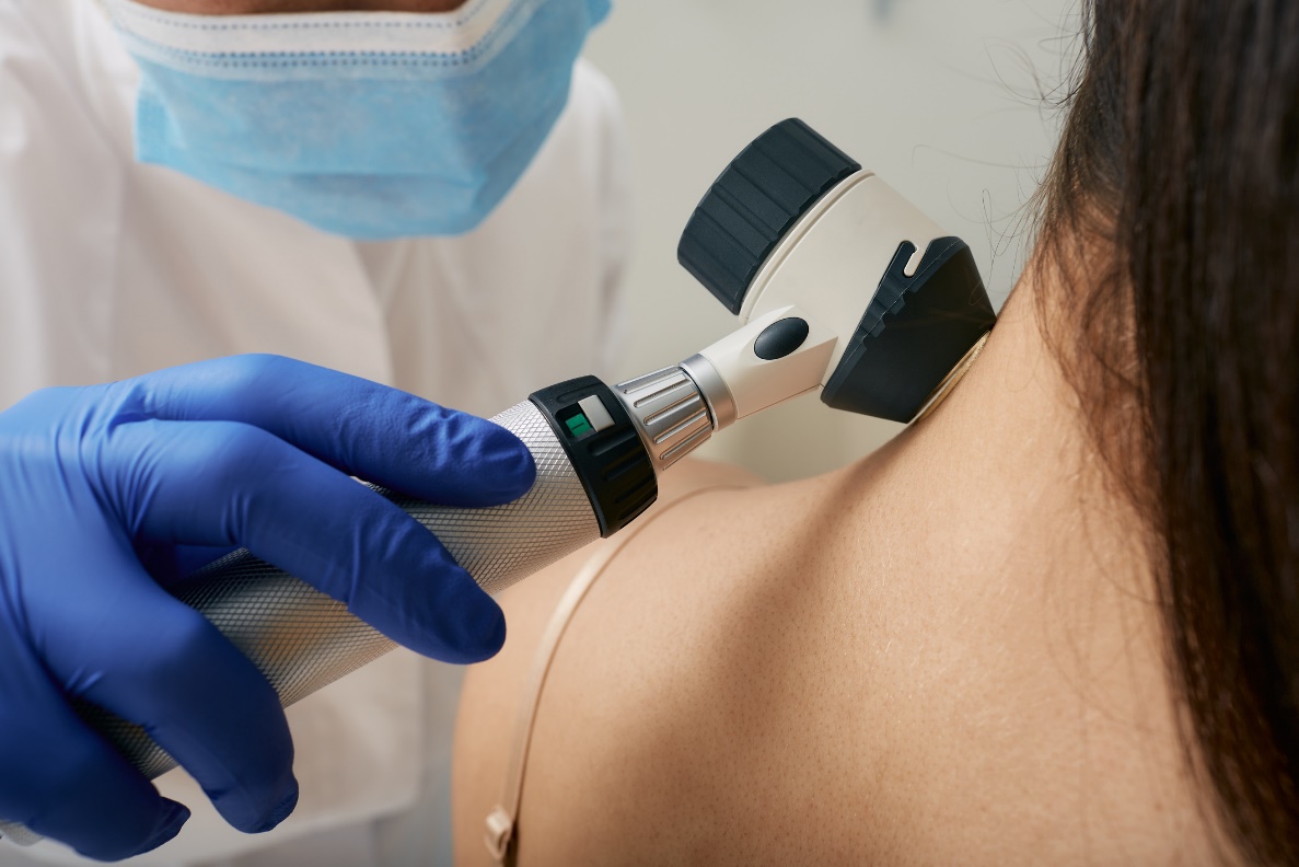 Examen médical des formations cutanées à l'aide d'un dermascope