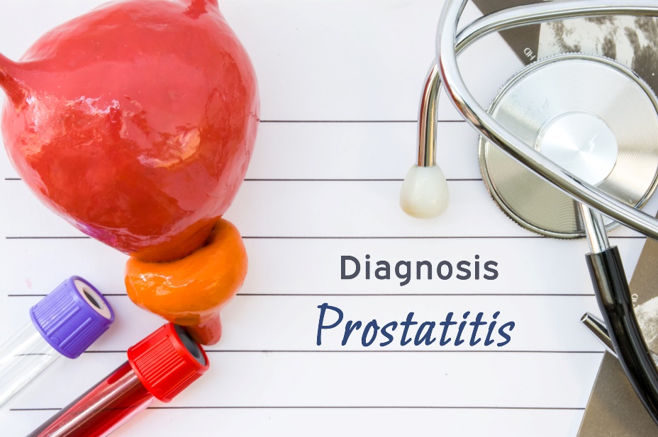 Inflammation de la prostate (prostatite) quelles sont ses causes et ses symptômes