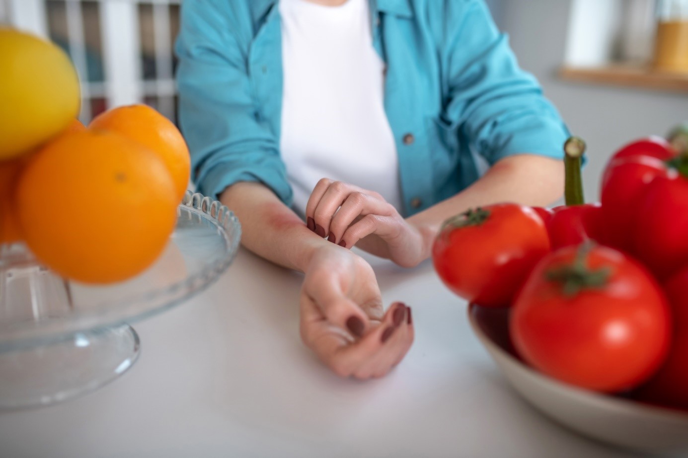 Une femme a de l'urticaire après avoir mangé des fruits ou des légumes et se gratte l'avant-bras.