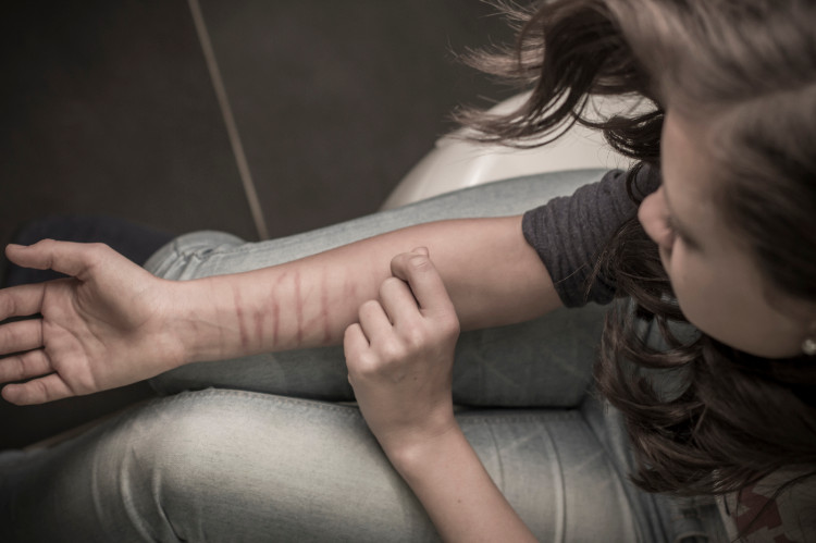 une jeune femme se coupe l'avant-bras avec un objet tranchant