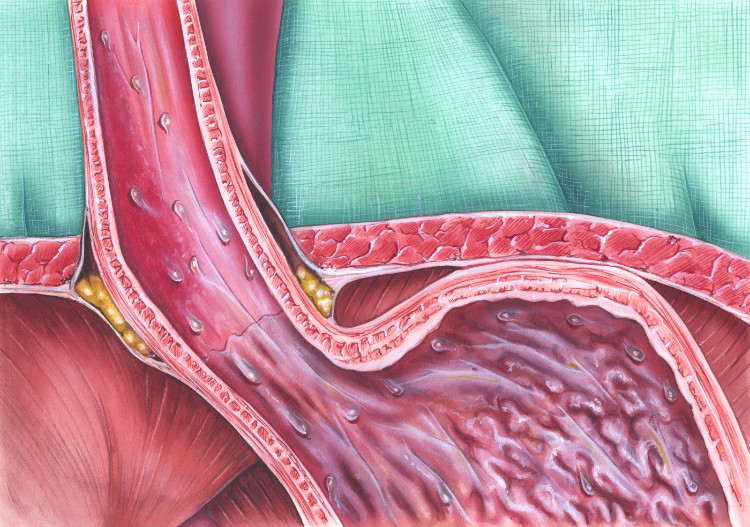 sphincter de l'œsophage représenté de manière anatomique