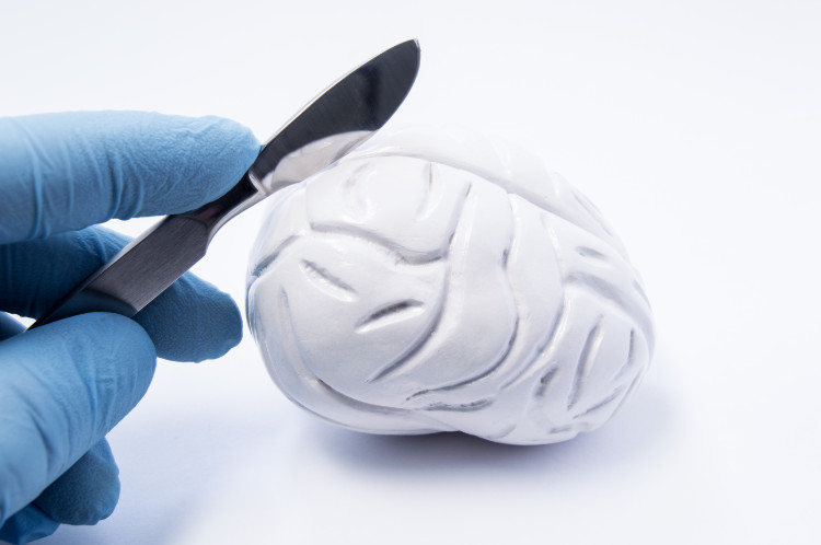 une main tenant un scalpel au-dessus d'une maquette de cerveau