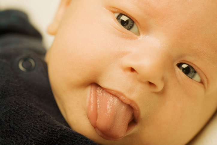 enfant avec jaunisse langue rampante