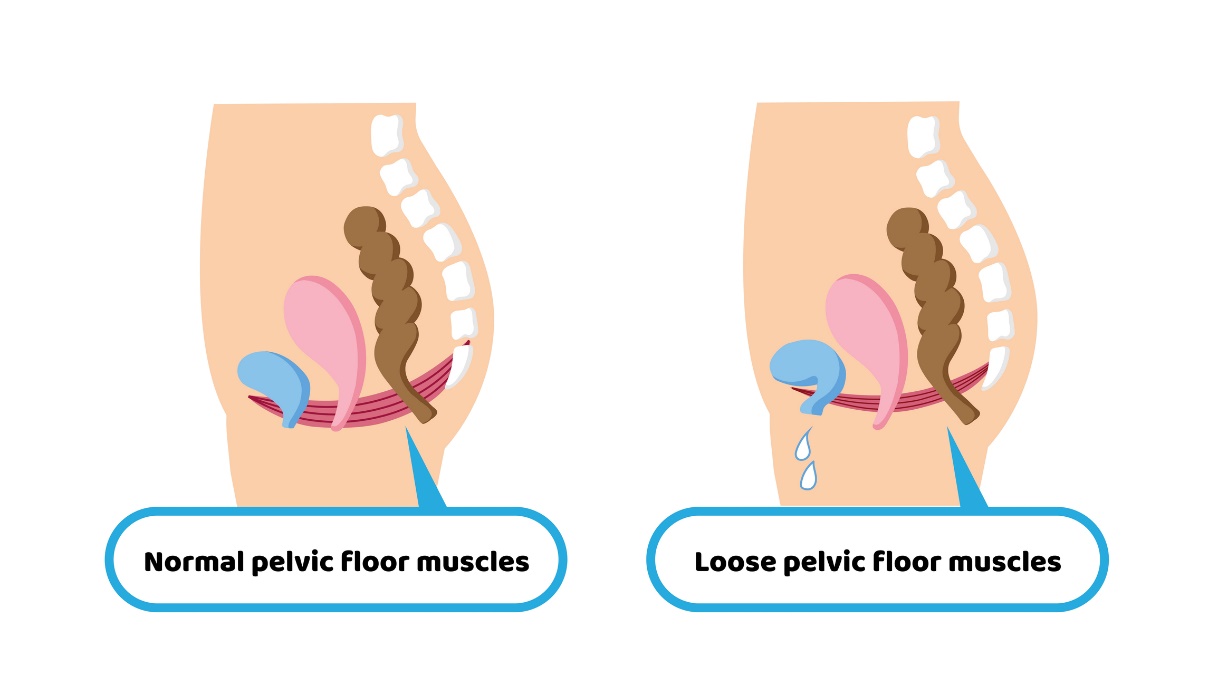 Physiologie des muscles du plancher pelvien et faiblesse des muscles du plancher pelvien