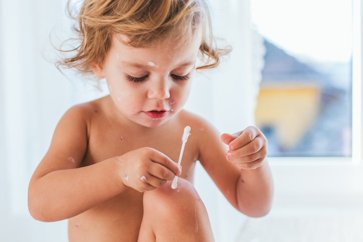 Une enfant nue traite sa peau avec un coton-tige.