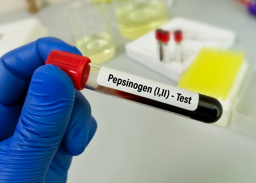 Echantillon de sang pour analyse en laboratoire des niveaux de pepsinogène et des maladies gastro-intestinales