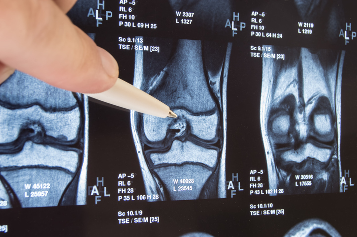 Radiographie de l'articulation