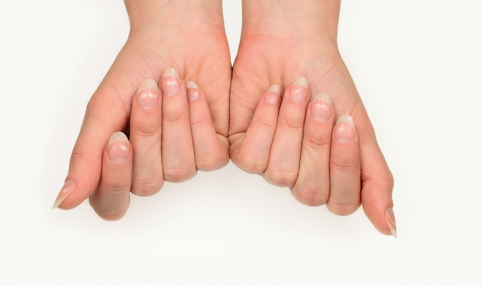 Taches Blanches Sur Les Ongles : Que Signifient-elles Et Quelles En ...