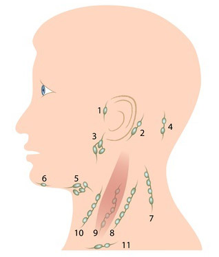 Nodules de la tête et du cou