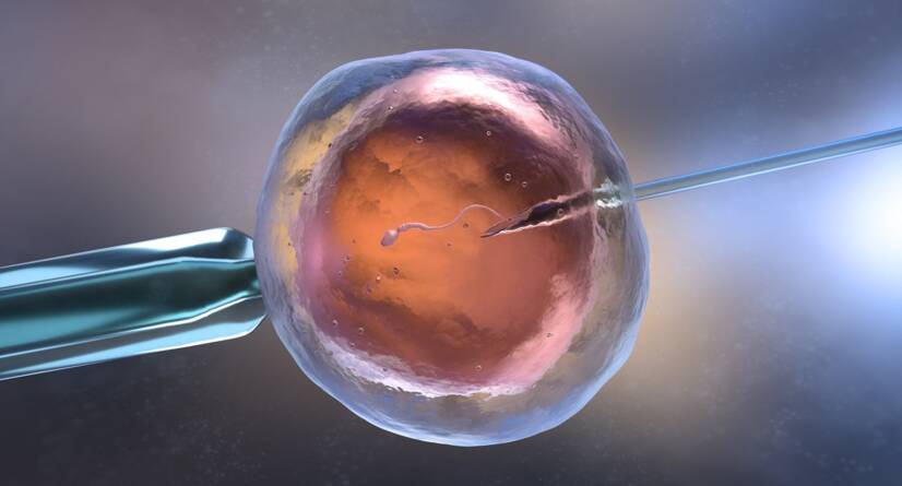 Fécondation in vitro (FIV) Source : Getty Images