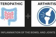 Arthrite entéropathique et maladie inflammatoire de l'intestin : quel est le lien entre les deux + Symptômes