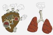 Hypertension pulmonaire : qu'est-ce que c'est et pourquoi cela se produit-il ? + Symptômes et traitement