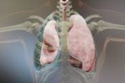 Pneumothorax (air dans la poitrine) : causes, symptômes et premiers secours